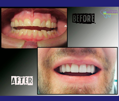 Slider image (3) Dental Brush Mexicali